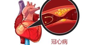 冠心病